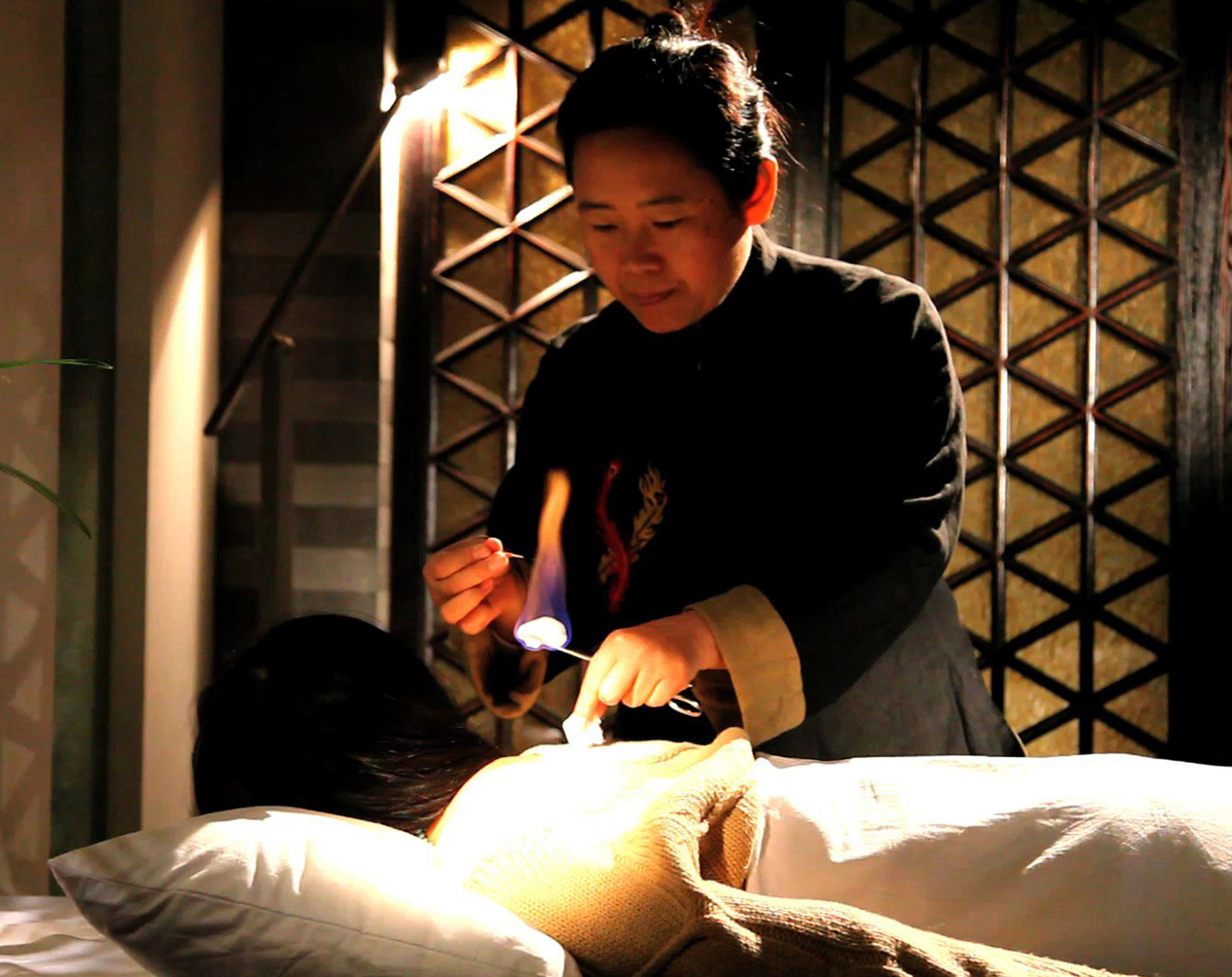 Traditional massage parlor. Традиционная китайская медицина акупунктура. Китайская медицина иглоукалывание. Акупунктура и прижигание в древнем Китае.
