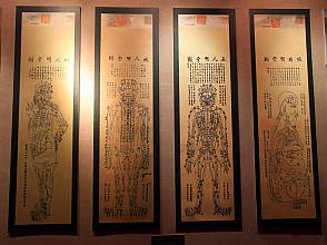 L’acupuncture et la moxibustion de la médecine traditionnelle chinoise