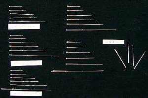 Acupuncture and moxibustion of traditional Chinese medicine